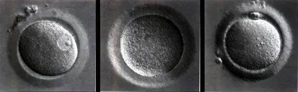 试管婴儿：为什么取卵那么多，成为胚胎的那么少？