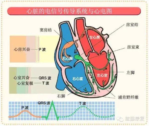 窦性心律到底是什么病？为啥很多心电图上都有这个？