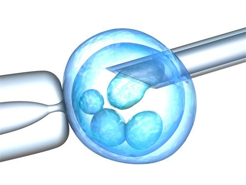 三代试管pgd筛查后还会出现胚胎染色体异常吗？染色体异常会导致哪些疾病