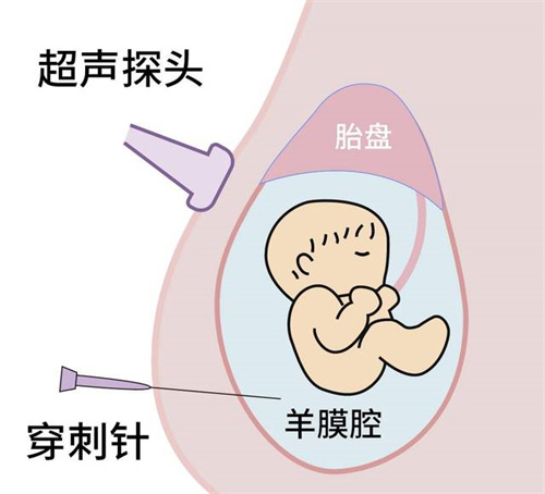 武汉试管婴儿哪个医院最好？试管婴儿包成功是真的吗?