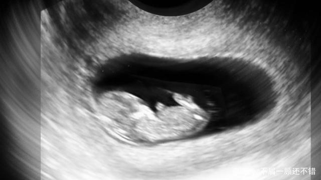 怀孕2个月的孕妈妈和胎宝宝会有什么变化？